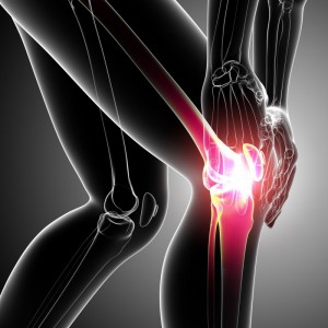 The Most Important Things That You Will Need to Know About Knee Pain
