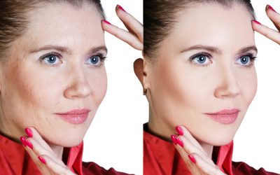 Smooth Fine Lines and Wrinkles with Morpheus8 Treatment – Luxe Beauty & Wellness on Tomball Pkwy